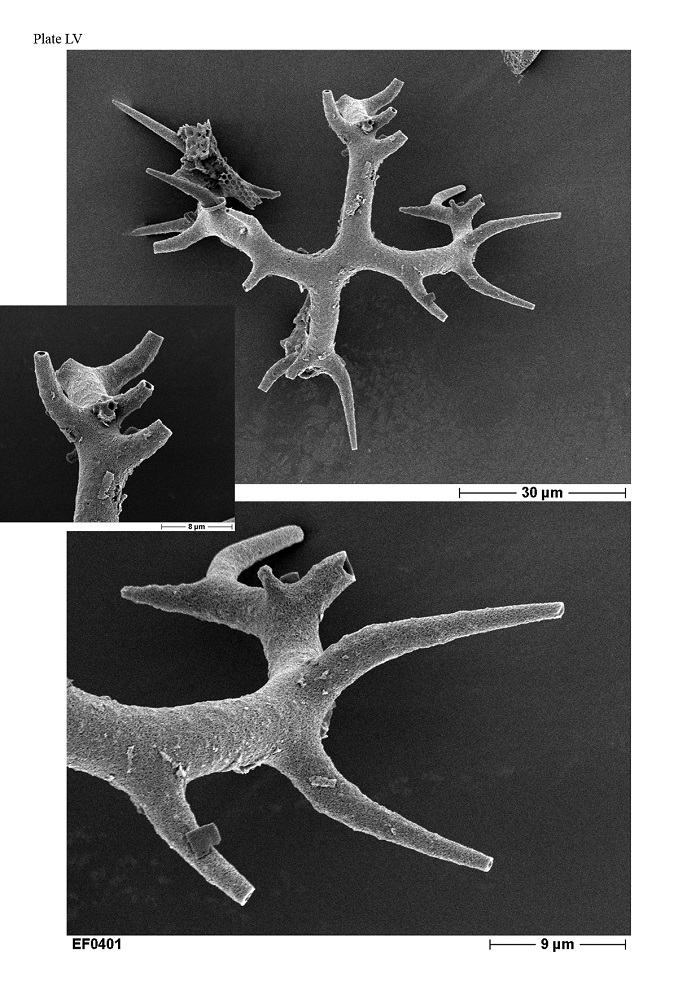 An image of a silicoflagellate microorganism from the Umpiocha genus.